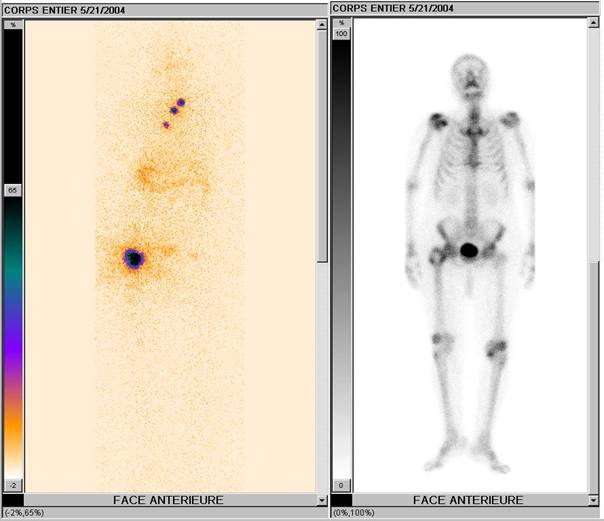 radiographie